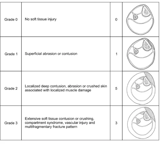 Fig. 2. Distribution of soft  tissue injury patterns is shown  in this figure using the  Ts-cherne and Goetzen 20)   classifi-cation in this study.