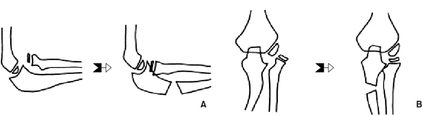 Fig. 3. Revised from the article of Hirayama T, Takemitsu Y, Yagihara K, Mikita A (Fig
