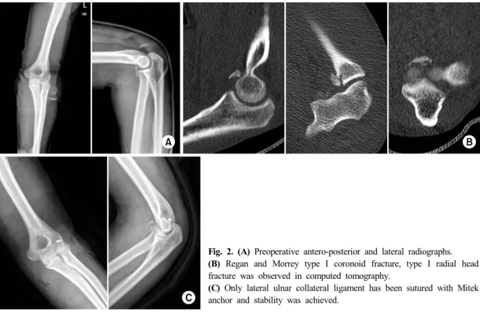 Fig. 2. (A) Preoperative antero-posterior and lateral radiographs.
