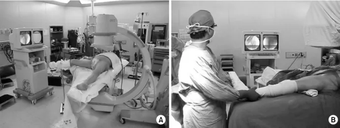 Fig. 1.  (A)  C-arm image is checked without using fracture table preoperatively. 