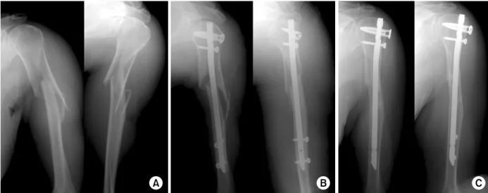 Fig. 1. Extended type, 51-year-old man. 