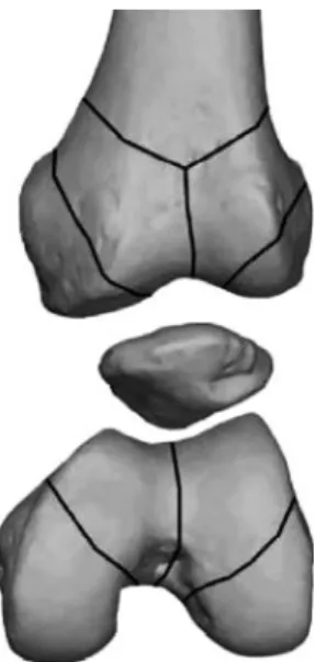 Fig. 1. Lines of weakness on the distal femur.