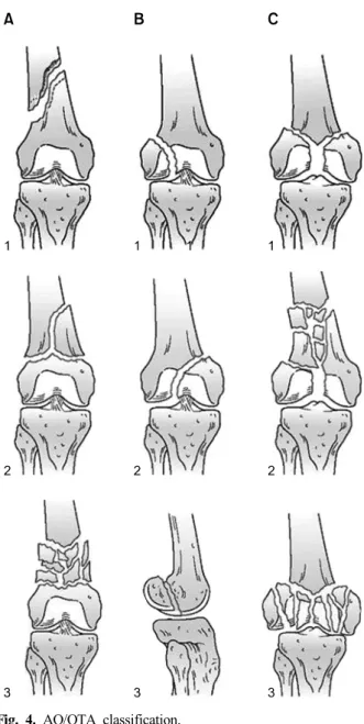 Fig. 3. (A) Implant (distal screws) that appear of appropriate  length.