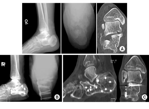 Fig. 1. 54-year-old male patient.