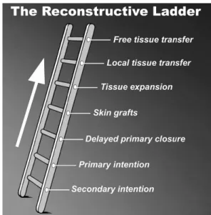 Fig. 1. Reconstruction ladder for the reconstruction of soft  tissue defect.