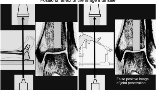 Fig. 2. Image intensifier must  be placed perpendicular to the  ankle joint.
