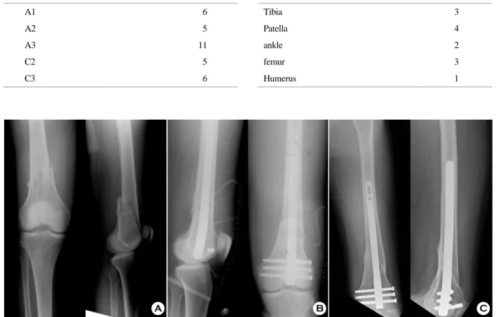 Table 4. Associated fractures 