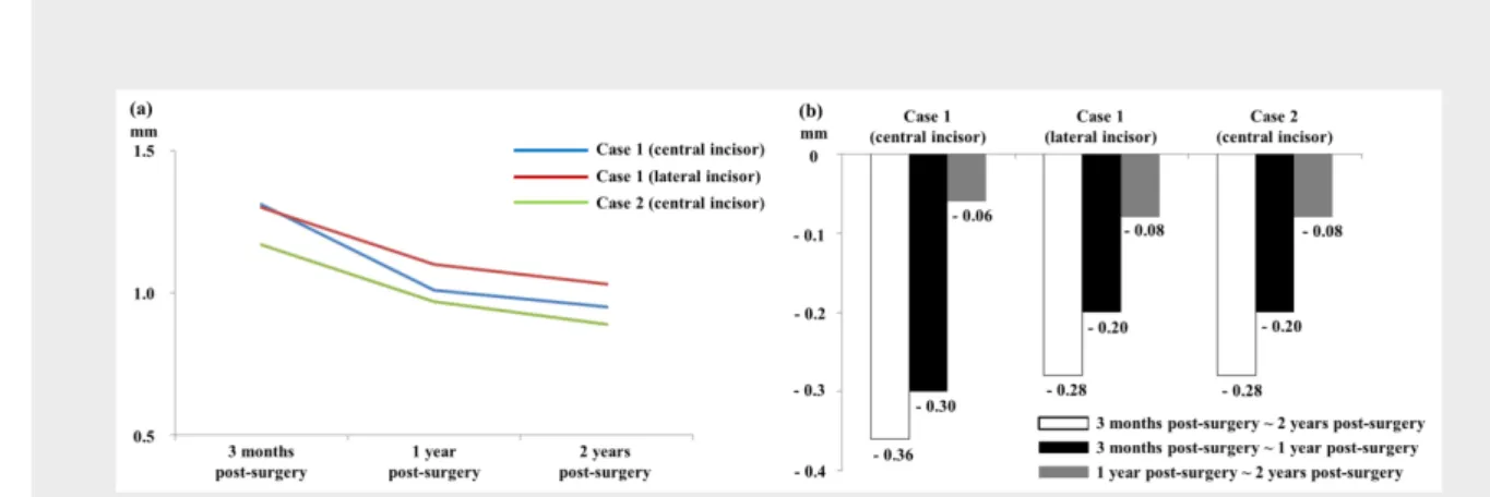 Table 1. Volume gains at 3 months, 1 year and 2 years postsurgery compared to presurgery (mm).