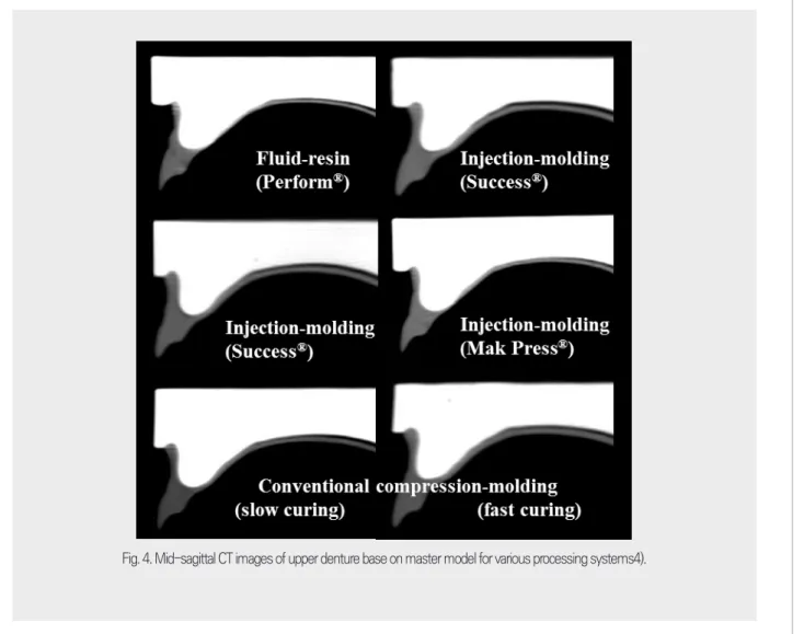 Fig. 4. Mid-sagittal CT images of upper denture base on master model for various processing systems4).
