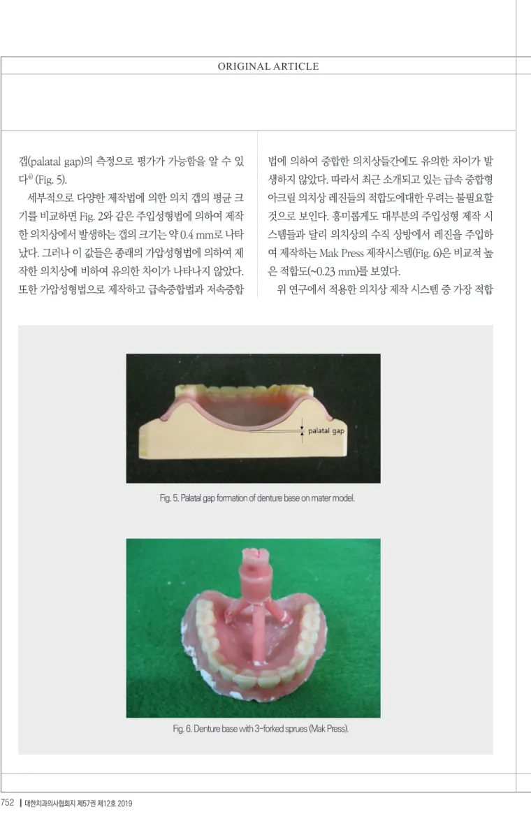 Fig. 5. Palatal gap formation of denture base on mater model.
