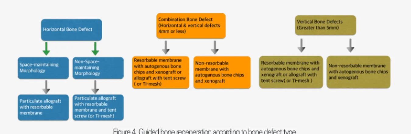 Figure 4. Guided bone regeneration according to bone defect type