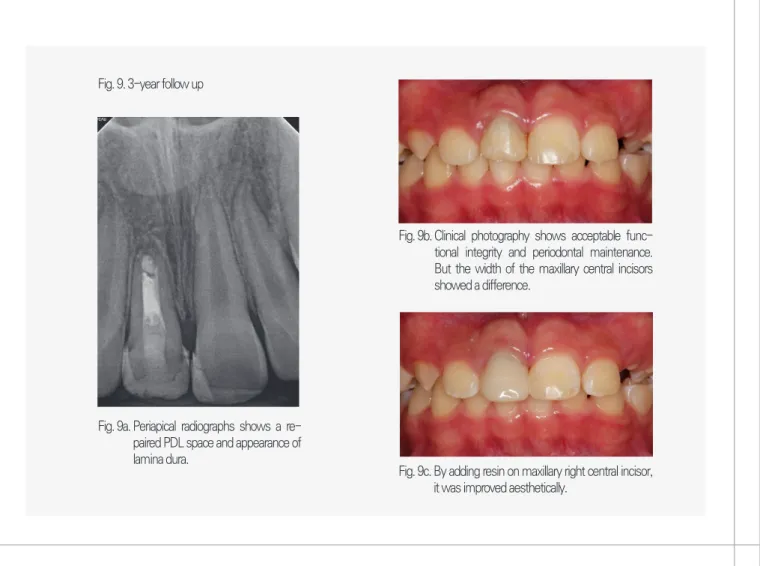 Fig. 9. 3-year follow up