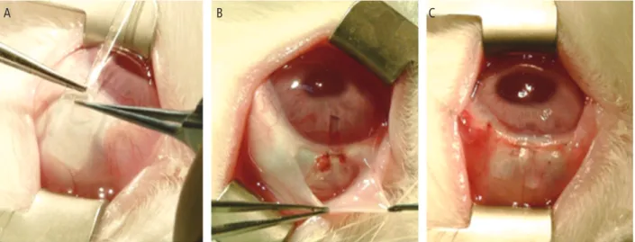 Fig. 1. Surgical procedure. 