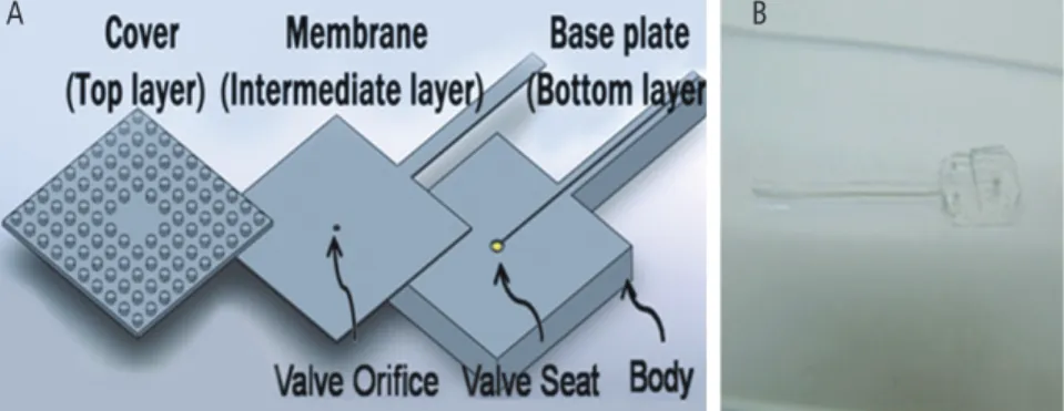 Fig. 2. Illustration of a glaucoma drainage device.