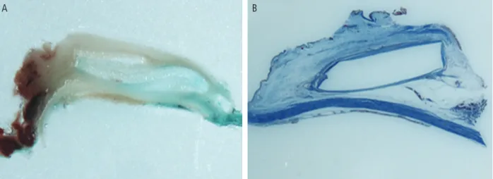 Fig. 5. Microscopic images of histologic sections after enucleation.