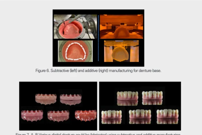 Figure 6. Subtractive (left) and additive (right) manufacturing for denture base. 