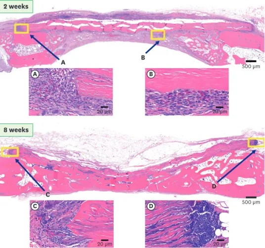 Figure 5. Histologic images of the CCM group (H&amp;E staining). At 2 weeks, infiltration of inflammatory cells was  observed around the CCM