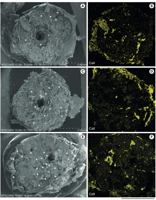 Figure 6. Representative SEM and their corresponding EDS mapping images of elemental calcium on the  fracture surfaces of the porous polyethylene side after interfacial shear testing