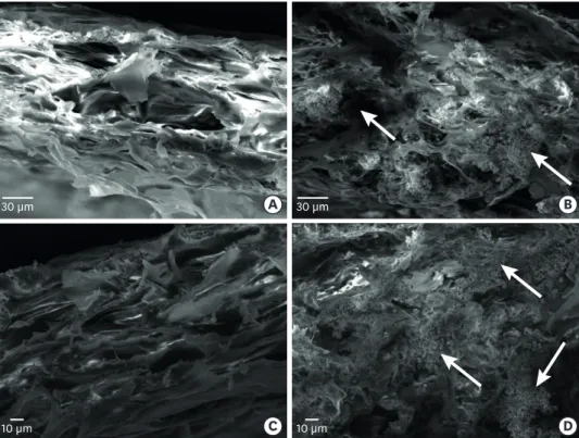 Figure 5. Scanning electron microscopy observations of the membrane cross-section. (A) Collagen membrane  with no BCP added