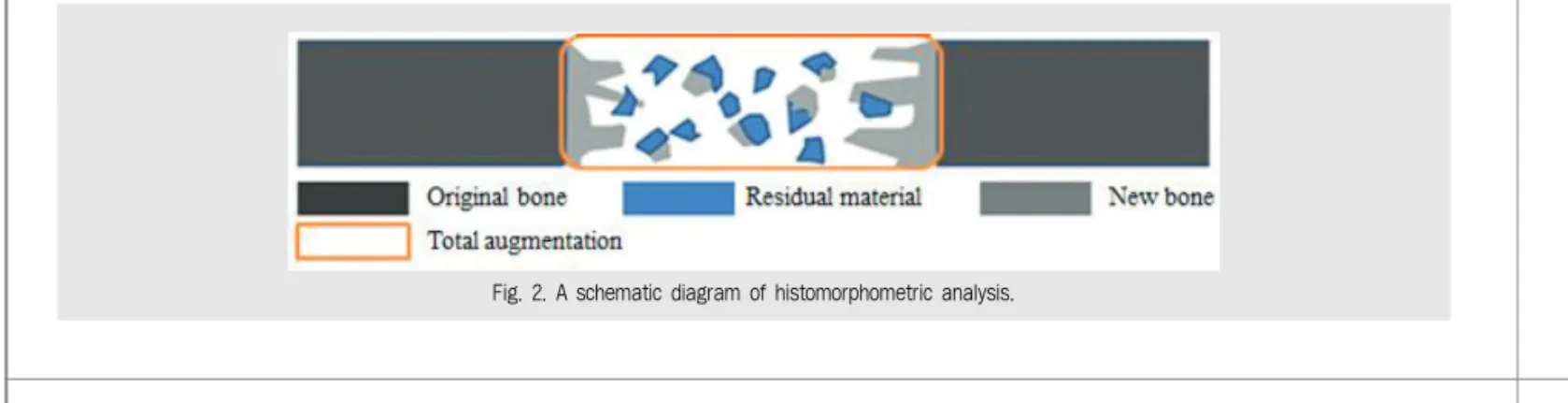 Fig. 2. A schematic diagram of histomorphometric analysis. 