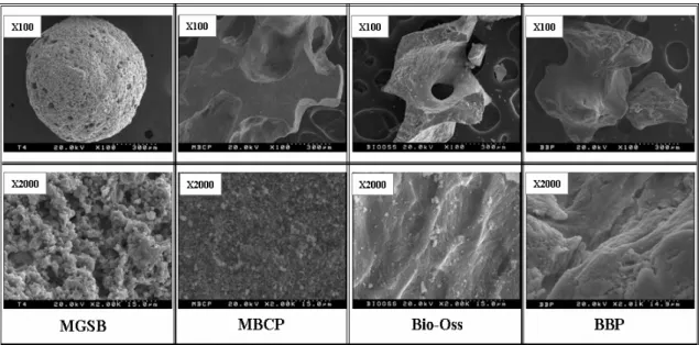 Figure 2. SEM images of different bone substitutes at magnifications of × 100 (upper) and × 2,000 (lower).