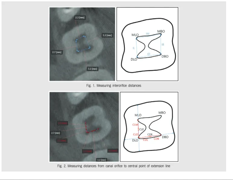 Fig. 1. Measuring interorifice distances