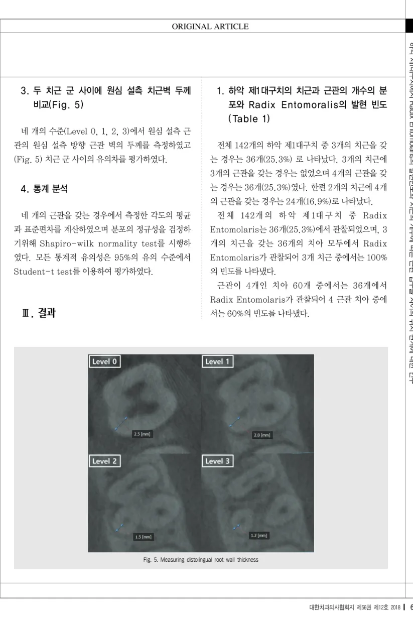 Fig. 5. Measuring distolingual root wall thickness