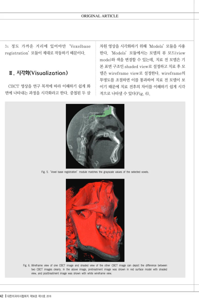 Fig. 6. Wireframe view of one CBCT image and shaded view of the other CBCT image can depict the difference between two CBCT images clearly