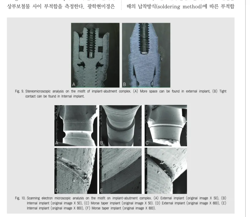 Fig. 9. Stereomicroscopic analysis on the misfit of implant-abutment complex. (A) More space can be found in external implant, (B) Tight contact can be found in Internal implant.