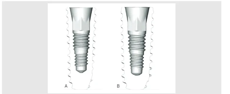 Fig. 11. Micro-CT evaluation of internal structure of compatible implant systems which having similar size and diameter