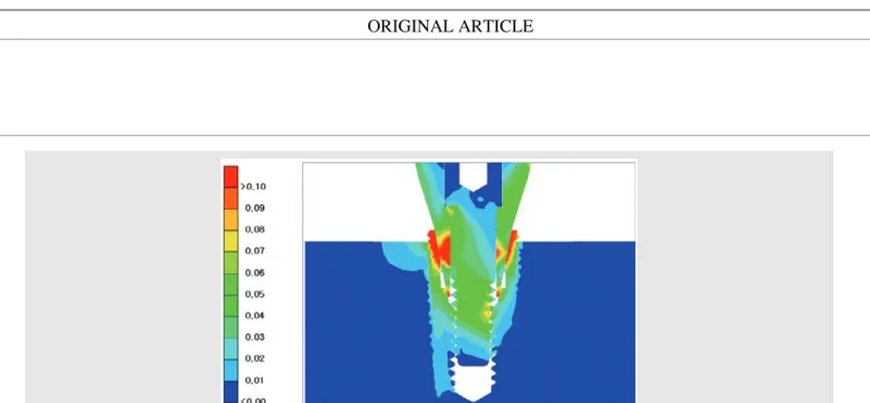 Fig. 6. An example of stress in implant-abutment using finite element analysis (FEA). Color in FEA only represent a scale to compare results.