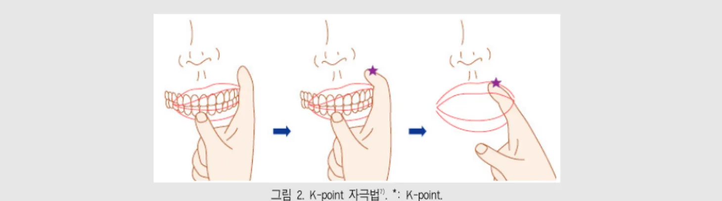 그림 2. K-point 자극법 7) . *: K-point.