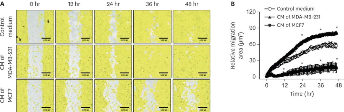 Fig. 2. Migration of human ECFCs after treatment with CM derived from MDA-MB-231 or MCF7