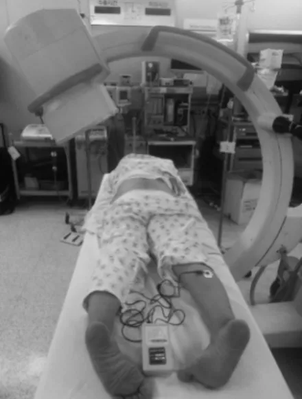 Fig. 2. C-arm images during a lumbar transforaminal epidural steroid  injection of left L4 and L5