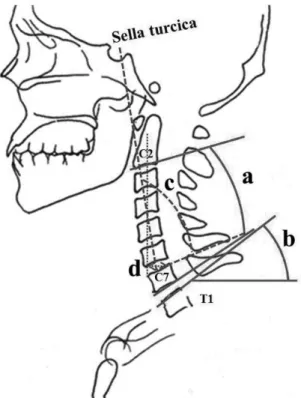 Fig. 3. Radiographic parameters. a. C2-7 lordosis: the angle between  the lower plate of C2 and the lower plate of C7