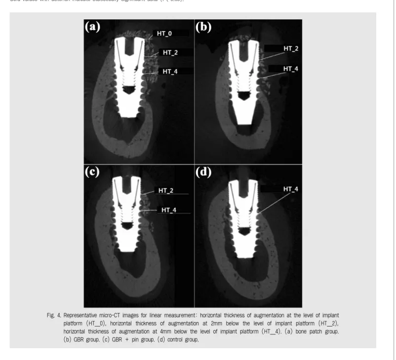 Fig. 4. Representative micro-CT images for linear measurement: horizontal thickness of augmentation at the level of implant platform  (HT_0),  horizontal  thickness  of  augmentation  at  2mm  below  the  level  of  implant  platform  (HT_2), horizontal th
