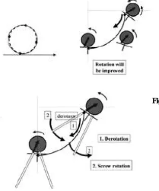 Fig. 4. Influence of rod torque to the apical screw(A). If the friction between rod and screw is minimal, the rotation of screw will be improved after derotation(B)