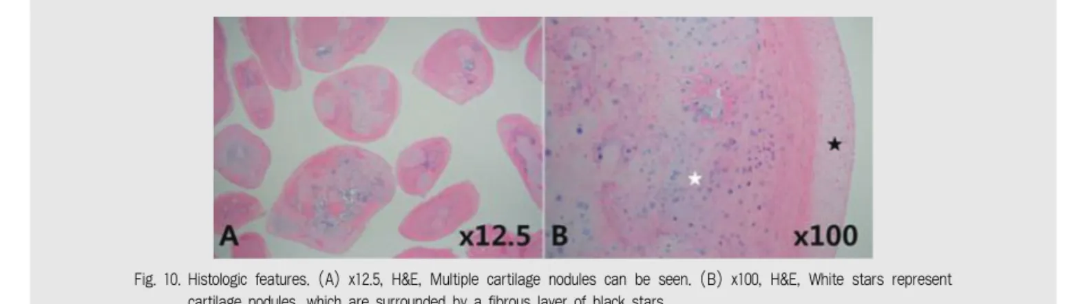 Fig. 10. Histologic features. (A) x12.5, H&amp;E, Multiple cartilage nodules can be seen