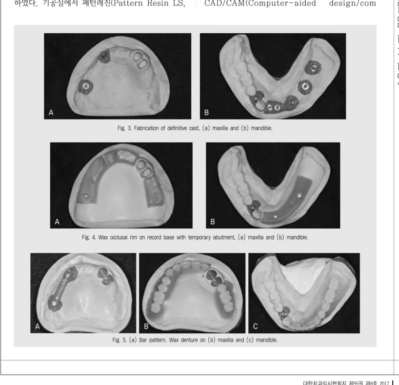 Fig. 3. Fabrication of definitive cast, (a) maxilla and (b) mandible.