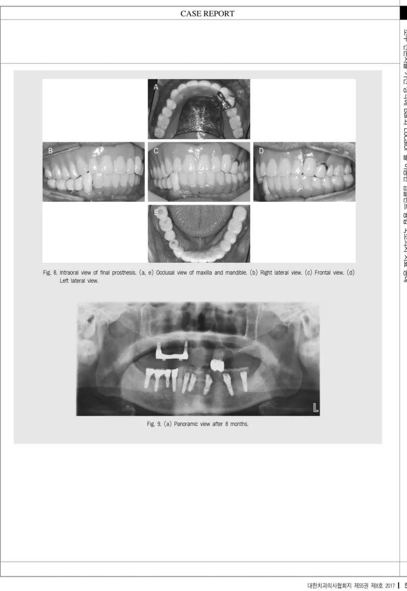 Fig. 9. (a) Panoramic view after 8 months. 