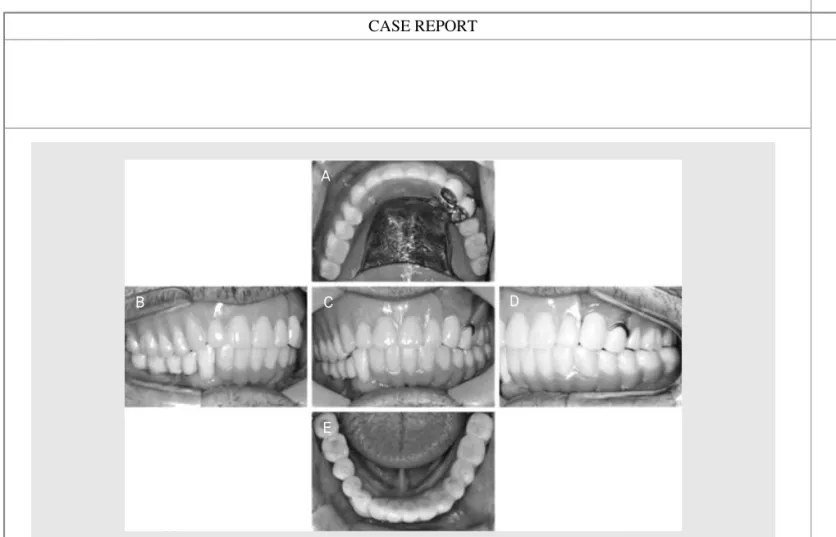 Fig. 10. Intraoral view after 8 months. (a, e) Occlusal view of maxilla and mandible. (b) Right lateral view