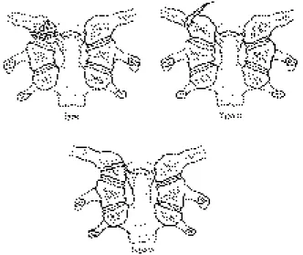 Fig. 1. Classification of occipital condyle fractures. Type I is an impaction fractures