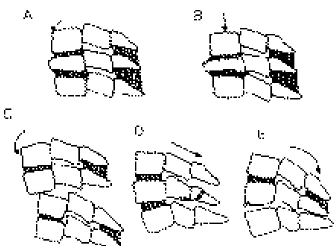Fig. 1. Mechanism of injury and direction of vector force in middle and lower cervical spine injury.