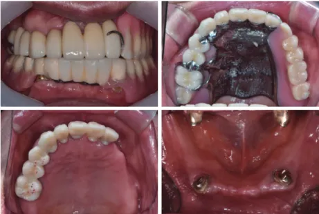 Fig. 1. Intraoral photographs before treatment.