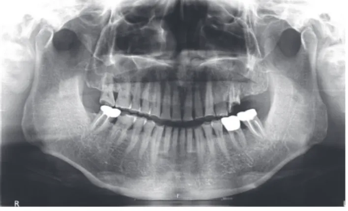 Fig. 1. Panoramic radiographic at the initial visit.