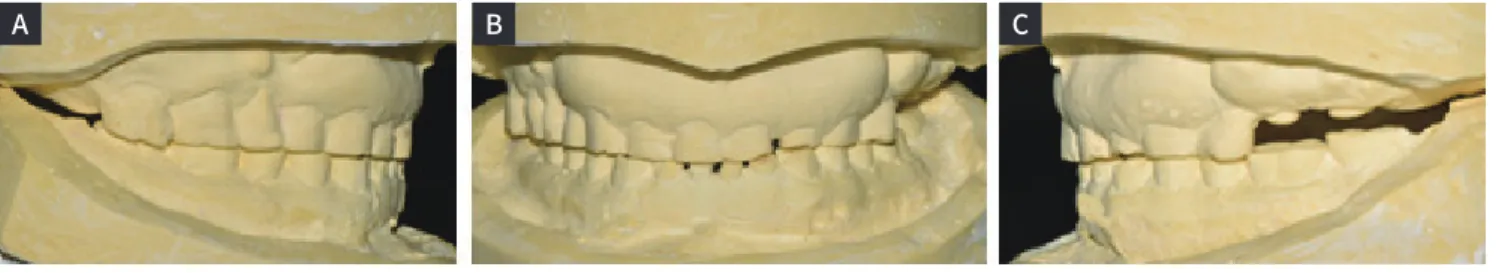 Fig. 4. Extra oral photograhs before treatment.