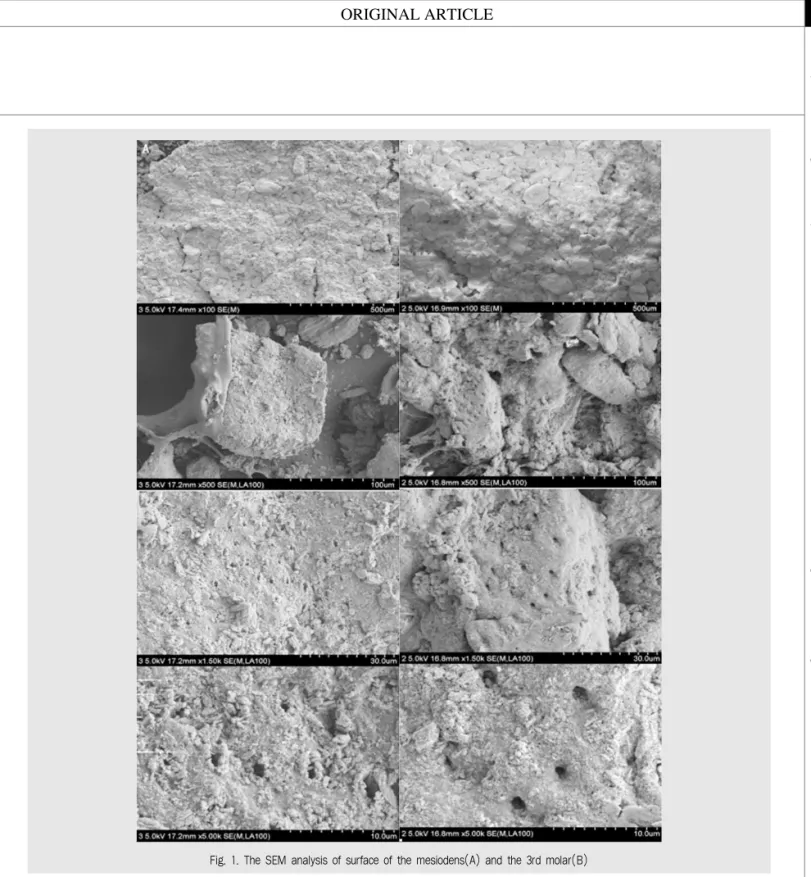 Fig. 1. The SEM analysis of surface of the mesiodens(A) and the 3rd molar(B)
