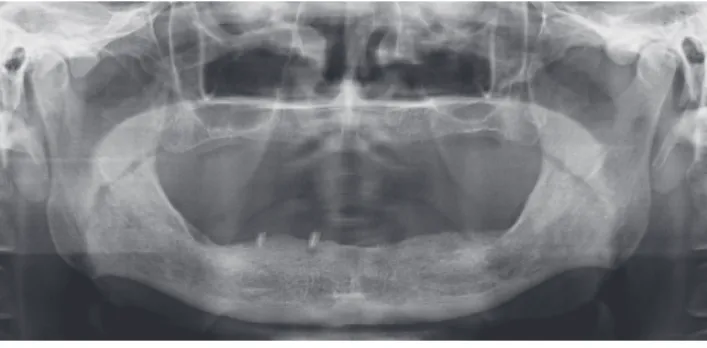 Table 1. Comparison of two different procedure