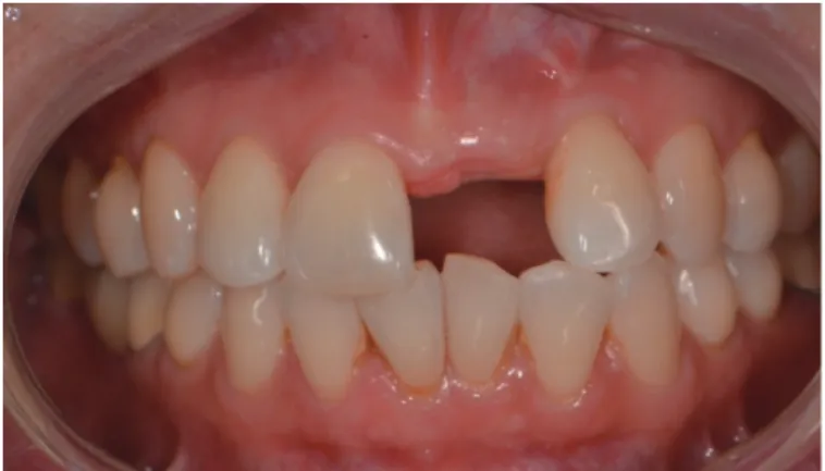 Fig. 1. Pretreatment. Frontal view.
