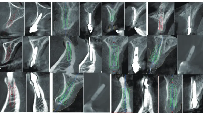 Fig. 8. CBCT scans obtained before and longer than 6 months after surgery from 12 patients.